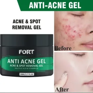 Acne Gel